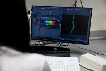 Analyse mikroskopischer Aufnahmen der fluoreszenzgefärbten Pilzstrukturen in Pflanzenwurzeln